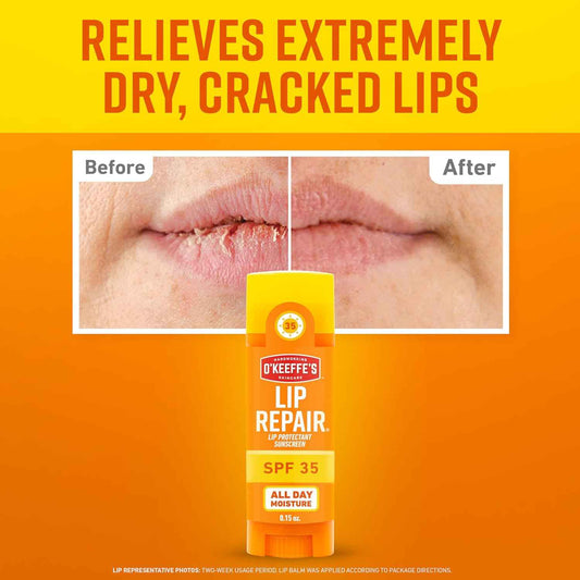 O'Keeffe's Lip Repair SPF 35 Lip Balm - Sun-Safe Moisturizer for Extremely Cracked, Dry Lips