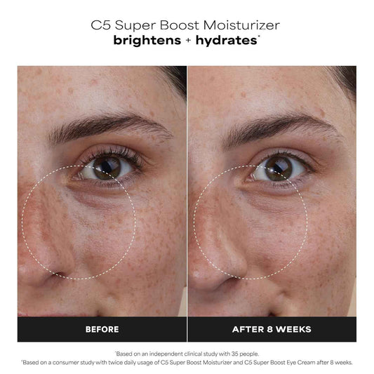 Paula's Choice C5 Super Boost Face Moisturizer with 5% Vitamin C & Squalane, Daily Face Lotion for Discoloration, Uneven Tone, Fine Lines & Breakout-Prone Skin, Fragrance-Free