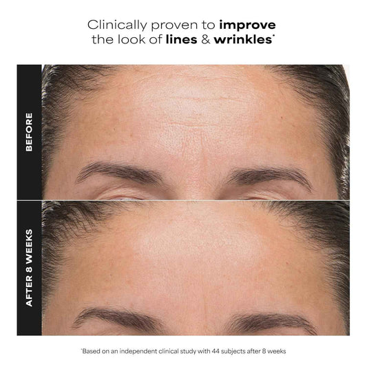 Paula’s Choice 6% Mandelic Acid + 2% Lactic Acid Exfoliant, Gentle Daily AHA Exfoliation for Discoloration, Bumpy Texture & Radiance, for Sensitive Skin, Fragrance-Free