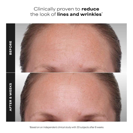 Paula's Choice CLINICAL 1% Retinol Treatment – Nightly Anti-Aging Ritual for Women 35+