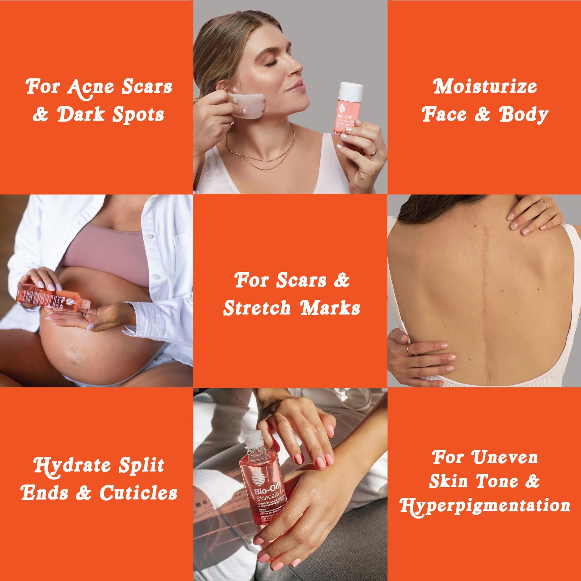 Bio-Oil_Skincare_Body_Oil,_Vitamin_E,_Serum_for_Scars_&_Stretchmarks,_Face_&_Body_Moisturizer,_2_oz,_All_Skin_Types