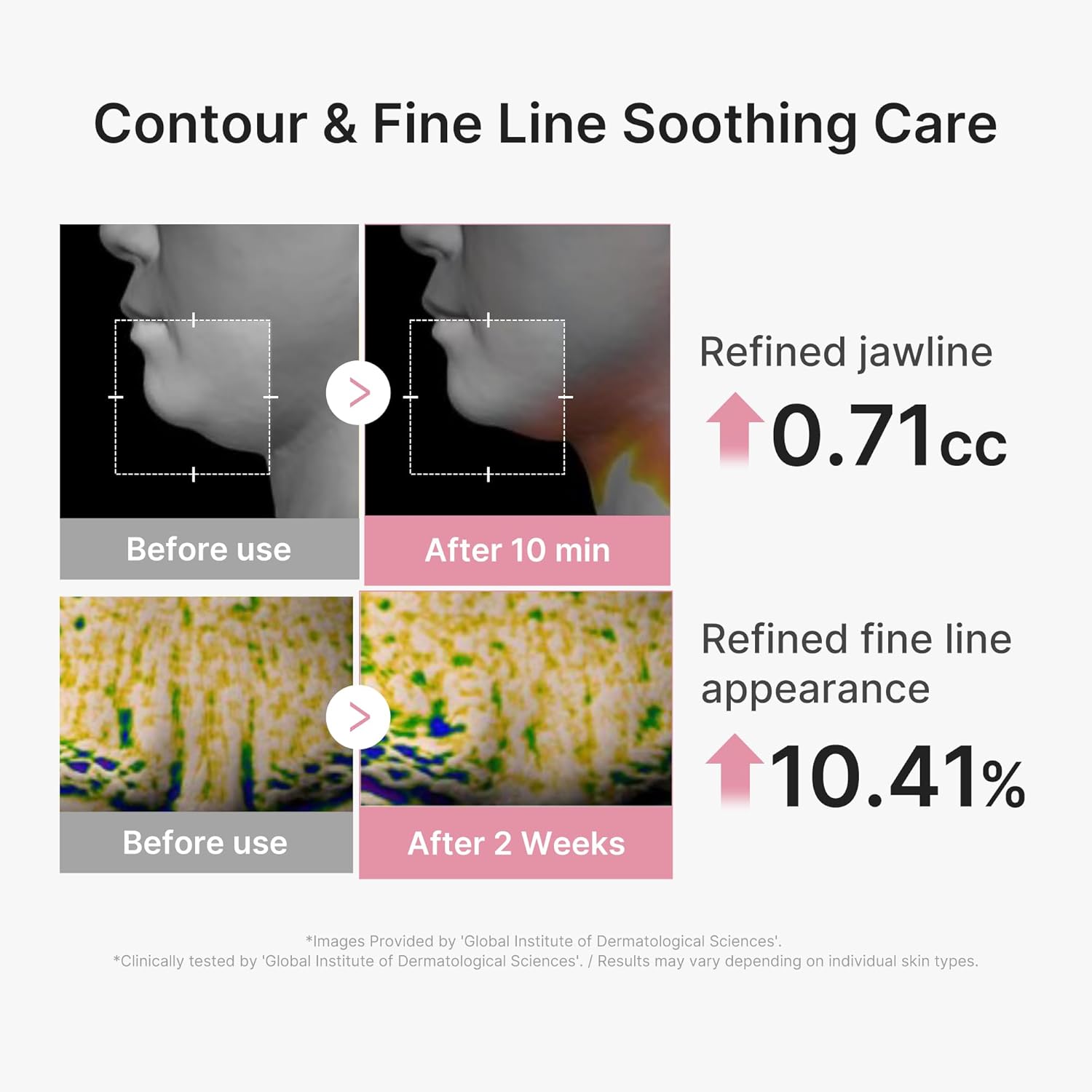 5% niacinamide for radiance and uneven tone refinement