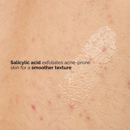 The Ordinary Salicylic Acid 0.5% Body Serum, Exfoliating Treatment for Acne-Prone Skin, 8.1 Fl Oz