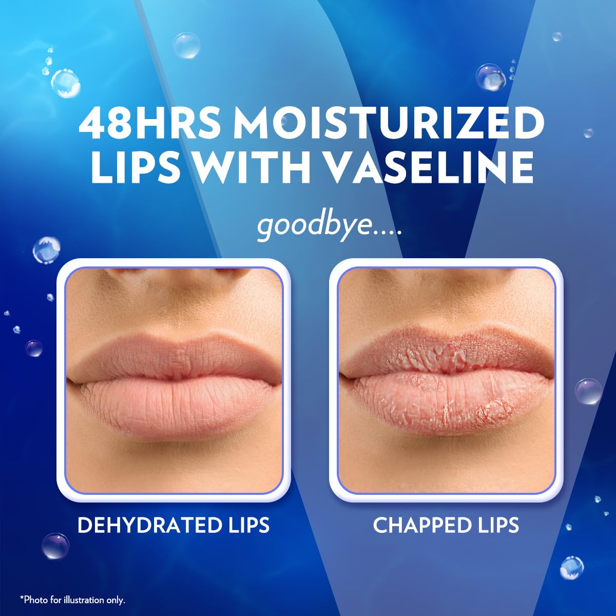 Vaseline_Lip_Therapy_Care_Original,_Fast-Acting_Nourishment,_Ideal_for_Chapped,_Dry,_Cracked,_or_Damaged_Lips,_Lip_Balm,_3-Pack_of_2,_0.16_Oz_Each,_6_Lip_Balms