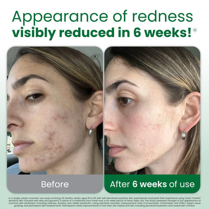Clean_Skin_Club_Clean_Towels®_XL_Sensitive_Skin_|_Ultra-Soft_Disposable_Face_Towels_Infused_with_Aloe_&_Glycerin_|_Dermatologist-Approved_Towels_for_Sensitive_Skin,_Makeup_Remover_Dry_Wipes,_50_count