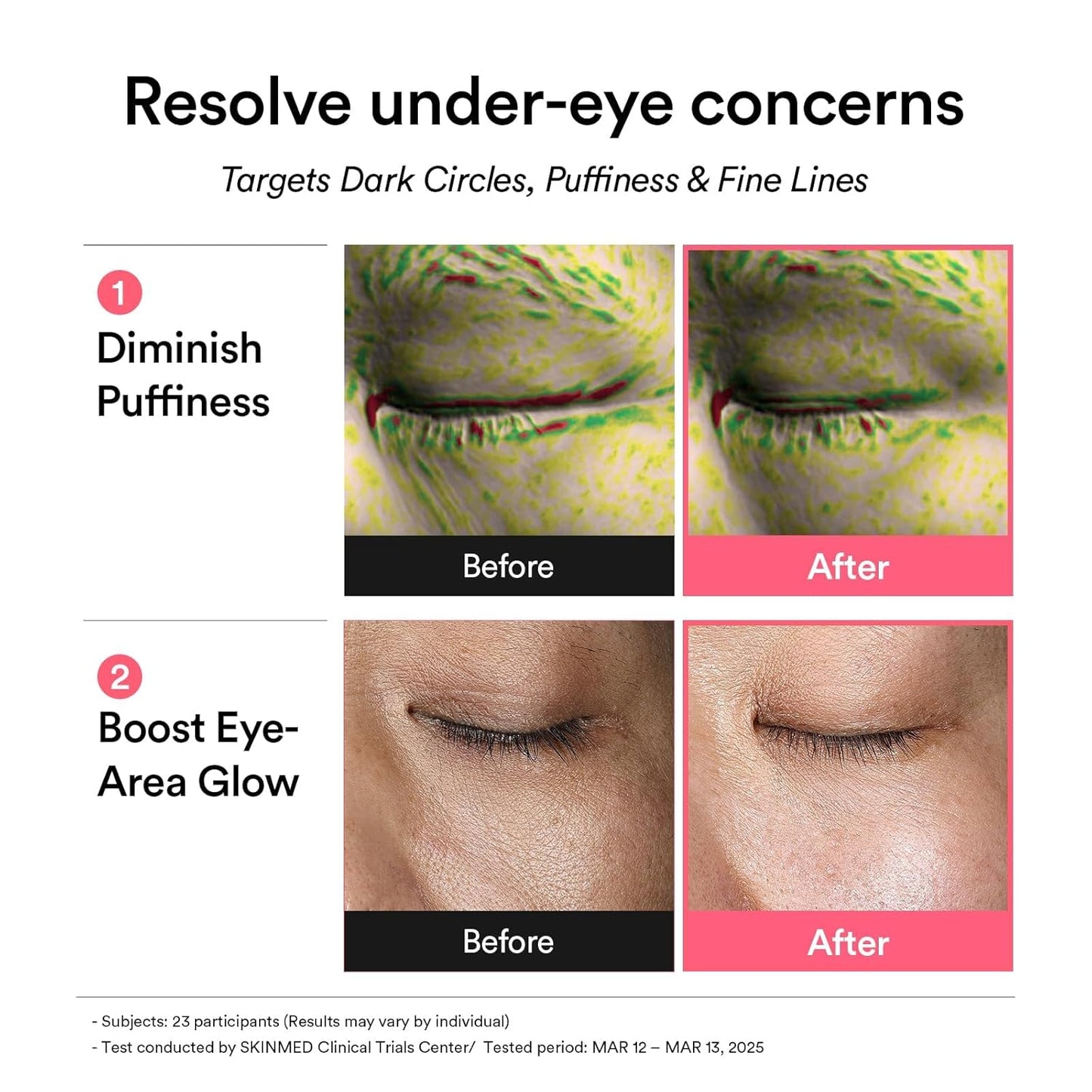 Abib_PDRN_Retinal_Eye_Patch,_Hydrogel_Masks_for_Dark_Circles,_Puffiness,_Fine_Lines,_60_Patches,_84g,_with_Niacinamide,_K-Beauty_Skincare