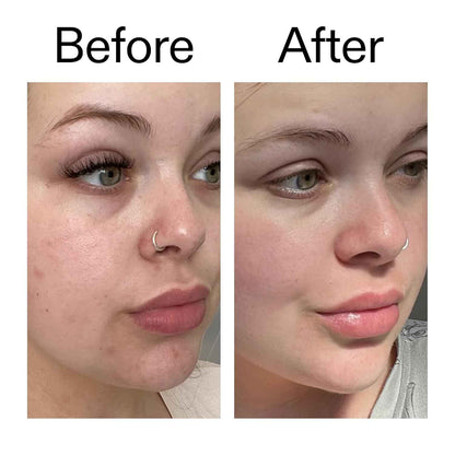 The INKEY List Omega Water Cream 1.69 fl oz/50ml, Oil-Free Face Moisturiser, Lightweight Gel, Vegan Friendly Skincare, Suitable For Blemish Prone Skin