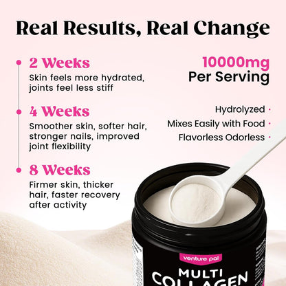 Venture_Pal_Multi_Collagen_Powder_Type_I,_II,_III,_V,_X_–_Hydrolyzed_Collagen_Peptides_MSM,_GC,_Hyaluronic_Acid_Vitamin_C_|_Collagen_Supplement_for_Women_|_Joint,_Hair,_Skin_&_Nail_Support_|_Non-GMO