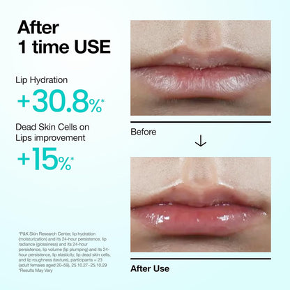 Anua_PDRN_Lip_Serum,_Long-lasting_Hydration_for_Dry,_Cracked_Lips,_Non-Sticky_Moisturizing_Lip_Care_with_Salmon_DNA,_Hyaluronic_Acid_&_Collagen,_Korean_Skincare,_0.33_fl.oz