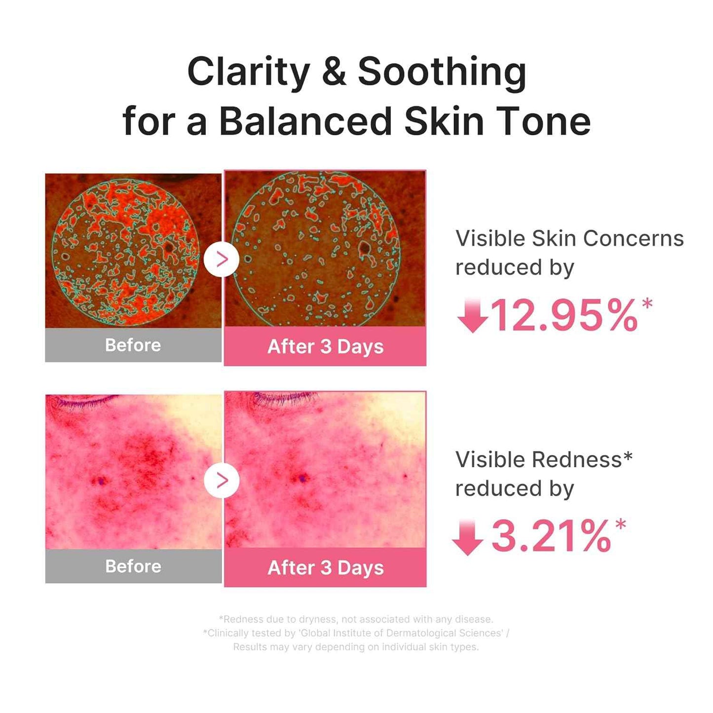 medicube PDRN Pink Peptide Serum | Hydrating Serum with Hyaluronic Acid | Fast-Absorbing Glow Care for Skin Clarity | Korean Skincare