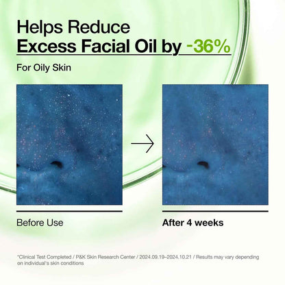 Anua Azelaic Acid 10 Hyaluron Redness Soothing Serum, Facial Serum for Blemish-Prone & Oily-Prone Skin, Lightweight & Hydrating Blemish Care, Hyaluronic Acid, Korean Skincare, 1.01 fl oz.