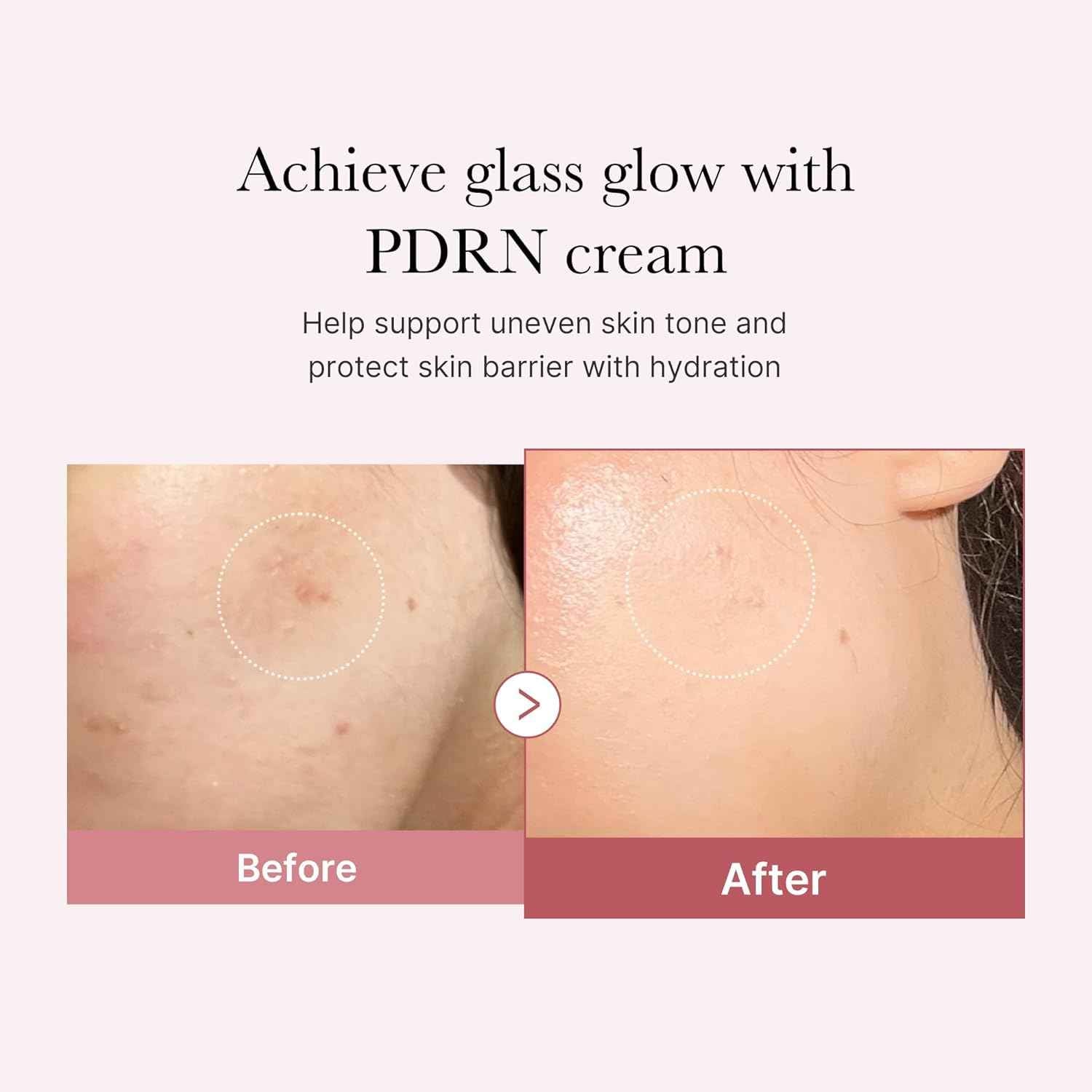 medicube PDRN Pink Hyaluronic Moisturizing Cream | Blemish Recovery, Relief & Hydrating Care | Restores Skin Elasticity & Glow | Korean Skincare for Even Skin Tone & Pore Care