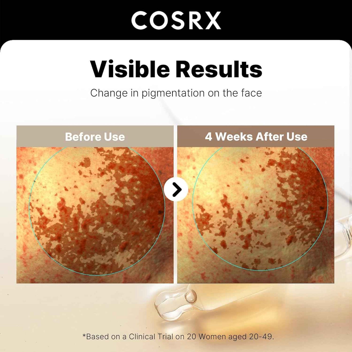 COSRX 2% Alpha Arbutin Discoloration Care Face Serum with Niacinamide, Glutathione & Tranexamic Acid, Dark Spot, Uneven Tone Care, Daily Korean Skin Care, Mothers Day Gifts for Woman, 1.7 fl oz