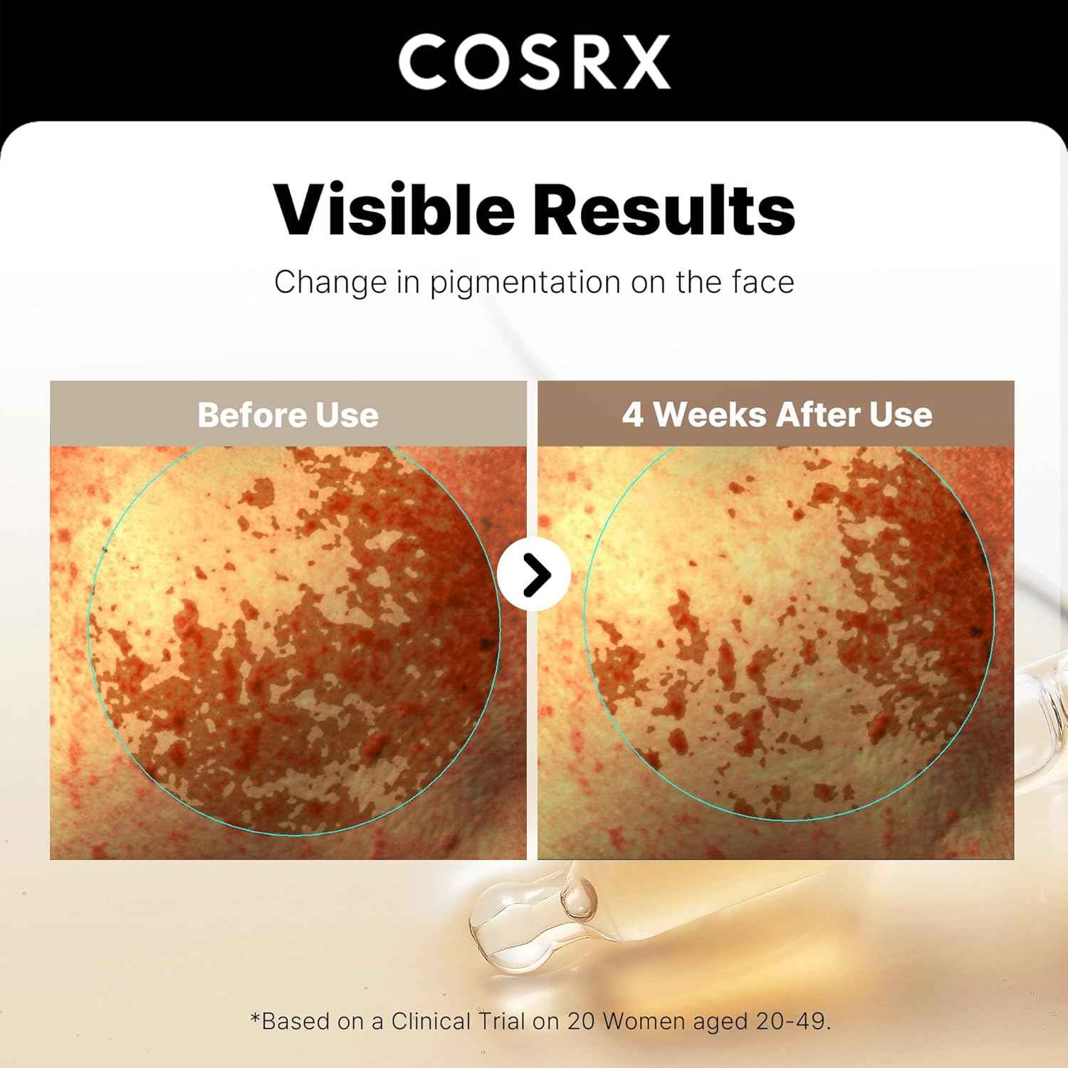 COSRX 2% Alpha Arbutin Discoloration Care Face Serum with Niacinamide, Glutathione & Tranexamic Acid, Dark Spot, Uneven Tone Care, Daily Korean Skin Care, Mothers Day Gifts for Woman, 1.7 fl oz