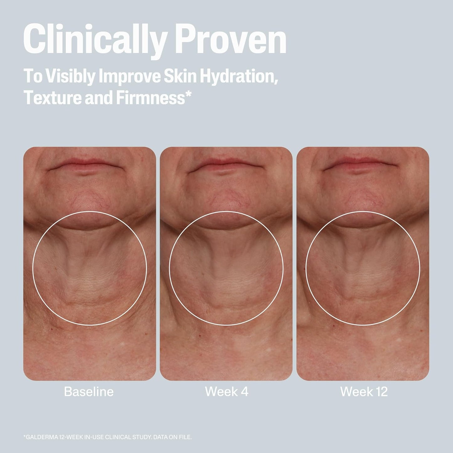 Cetaphil_Skin_Activator_Hydrating_&_Firming_Body_Cream_12oz,_Mandelic_Acid_(AHA)_and_Centella_Asiatica_(CICA)_Cream,_Hydrates_and_Firms_Aging_Skin,_Anti-Aging_Skincare,_12_oz