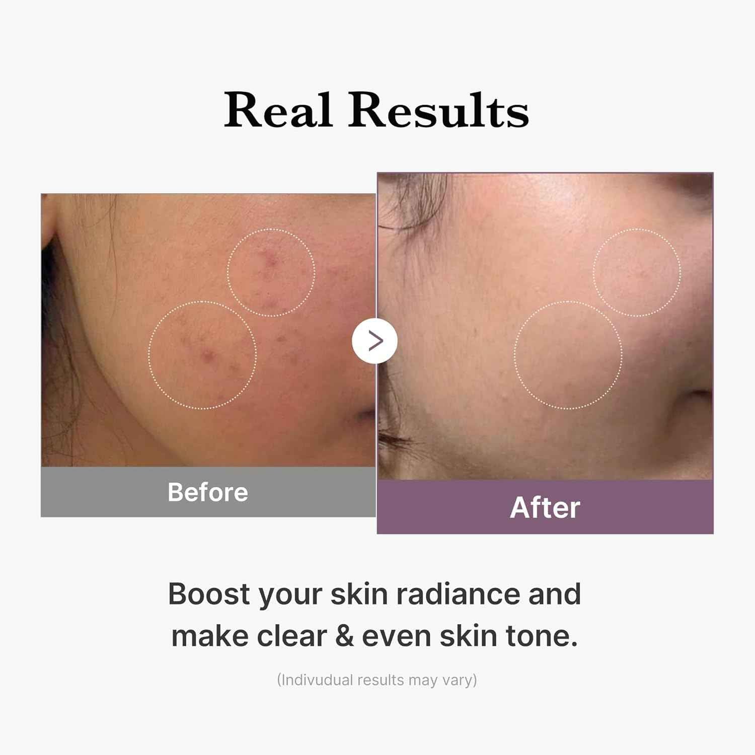 medicube Age-R Glutathione Glow Milky Toner, Low-Irritation Double Layer Toner for Glass Glow Skin with Peptide, Even Skin Tone, Radiance, Hydration, Korean Skincare