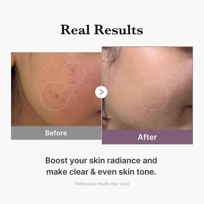 medicube Age-R Glutathione Glow Milky Toner, Low-Irritation Double Layer Toner for Glass Glow Skin with Peptide, Even Skin Tone, Radiance, Hydration, Korean Skincare
