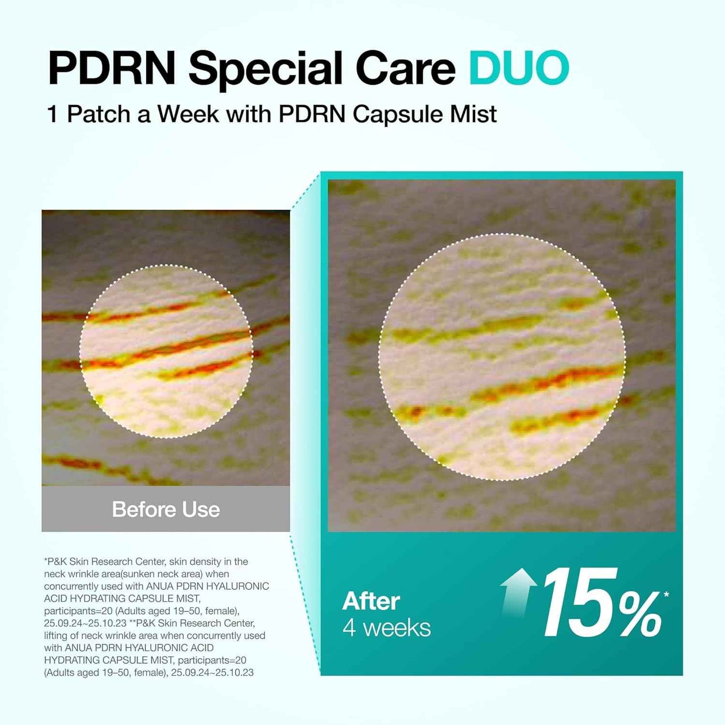 Anua PDRN Collagen Melting Patch for Neck, Lifting and Firming, Thin Film for Neck Fine Lines & Forehead, Plumping Effect with Salmon DNA, Korean Skincare, 0.02g x 4EA, Patch Only
