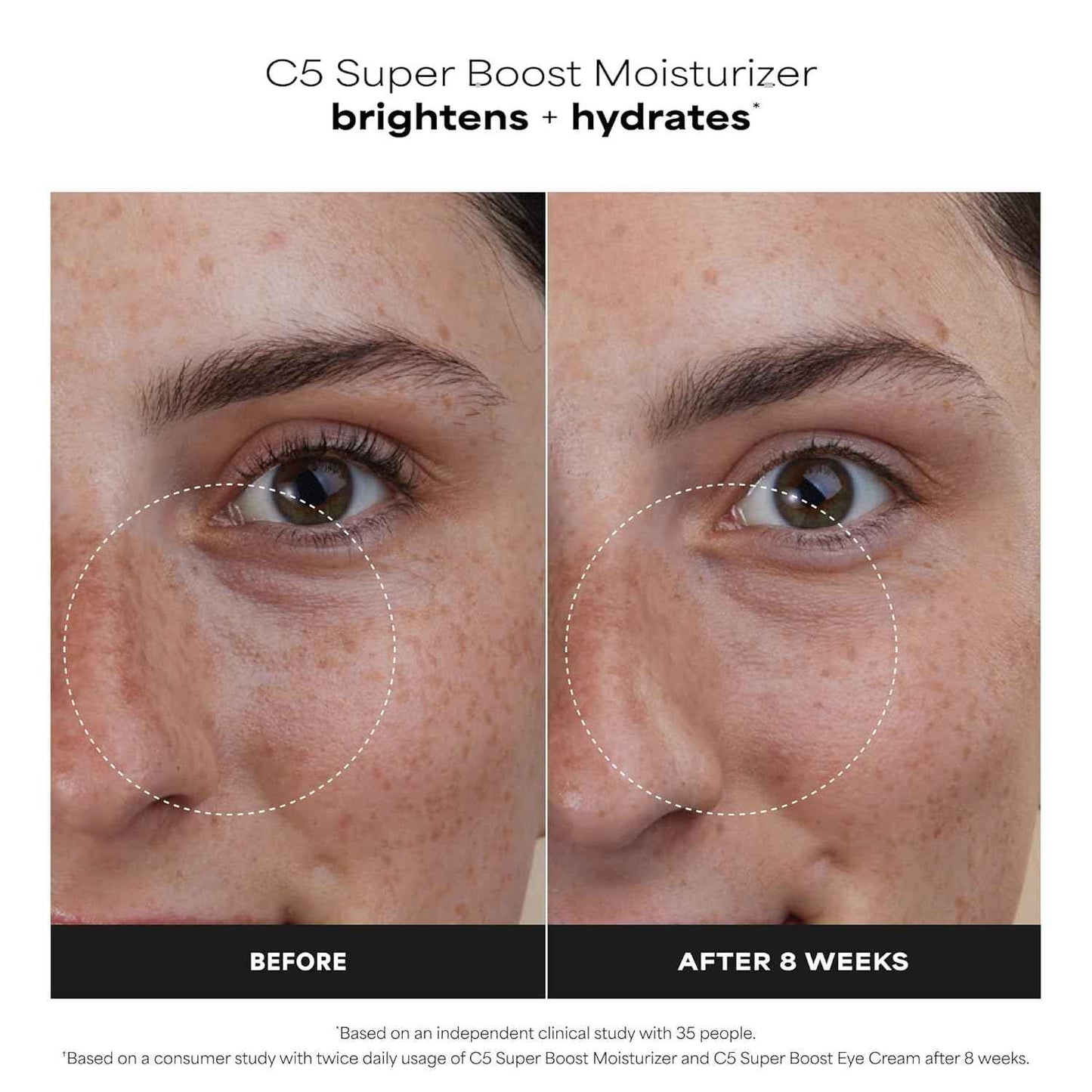 Paula's Choice C5 Super Boost Face Moisturizer with 5% Vitamin C & Squalane, Daily Face Lotion for Discoloration, Uneven Tone, Fine Lines & Breakout-Prone Skin, Fragrance-Free