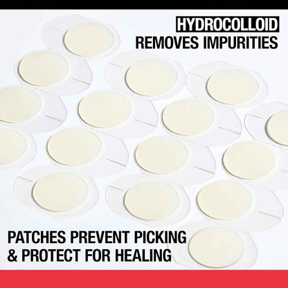 Neutrogena Stubborn Acne Ultra-Thin Patches for Acne-Prone Skin - Hydrocolloid Overnight Blemish Patch for Clear Skin, 24 Patches