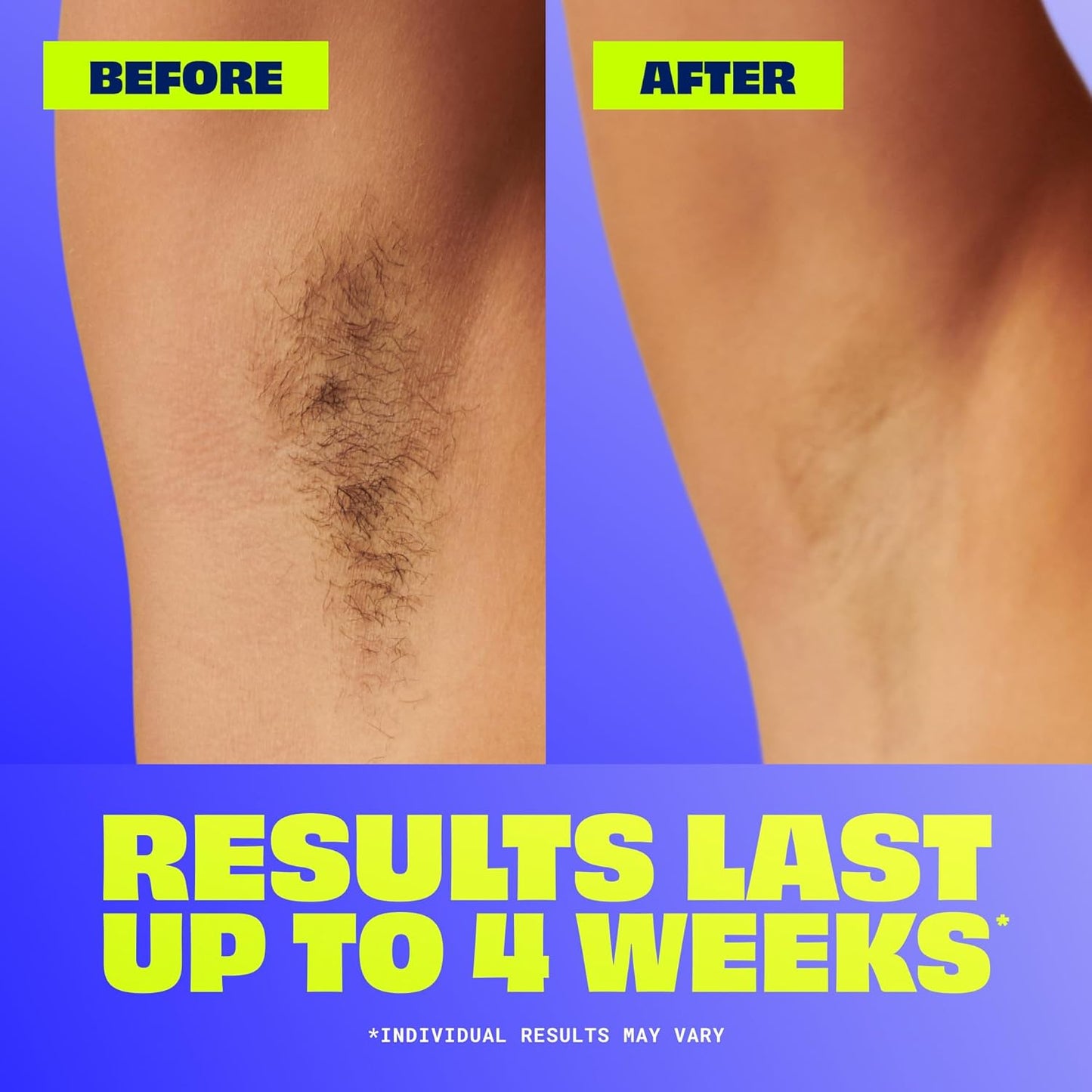 Nair_Sensitive_Hair_Remover_Mess-Free_Wax_Ready_Strips,_Legs_and_Body_Easy_Hair_Removal_Wax_Strips_for_Sensitive_Skin,_Chamomile_Extract,_Dermatologist_Tested,_Plus_6_Post_Wipes,_40_Count