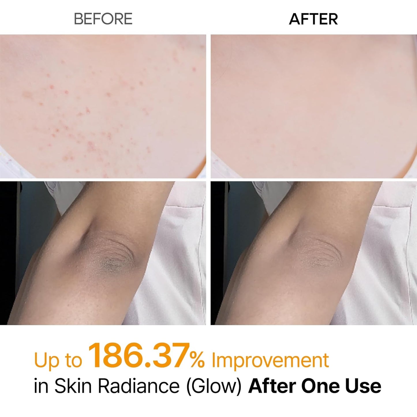 Dr.Melaxin_Body_Keratin_Care_Kojic_Acid_Turmeric_Spray_Gently_Exfoliating_Peeling_Solution_Korean_Skincare_All_Skin_Types_200ml