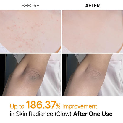 Dr.Melaxin_Body_Keratin_Care_Kojic_Acid_Turmeric_Spray_Gently_Exfoliating_Peeling_Solution_Korean_Skincare_All_Skin_Types_200ml