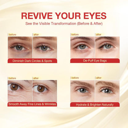 GONIM_Under_Eye_Patches_360°_Fit,_Eye_Mask_with_Collagen_Peptide,_Salmon_DNA_PDRN,_Caffeine,Retinol_&_Niacinamide,_Eye_Patches_for_Puffy_Eyes_and_Dark_Circles,_Travel_Essentials_4_pairs