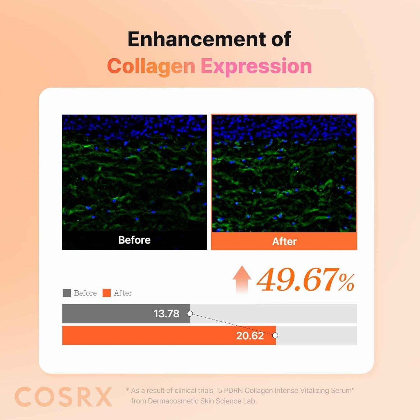 COSRX 5 PDRN Collagen Intense Vitalizing Serum - Korean Serum for Skin Firming & Glowing with Salmon DNA, Centella PDRN & Collagen, Mothers day gifts, Korean Skin Care (3.38 fl.oz.)