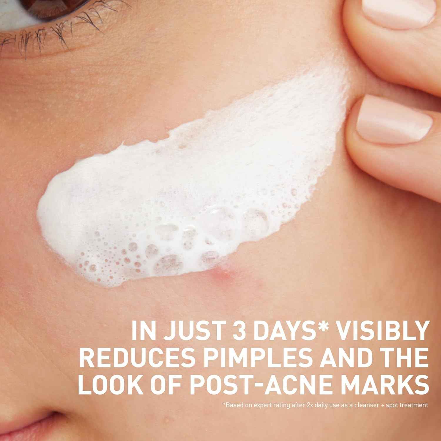 CeraVe Clay To Foam Acne Face Wash, Multi-Use Salicylic Acid & Kaolin Clay Acne Spot Treatment Clears Pimples & Blackheads, Prevents Breakouts, Hydrates & Soothes, Fragrance-Free, Non-Comedogenic, 4oz