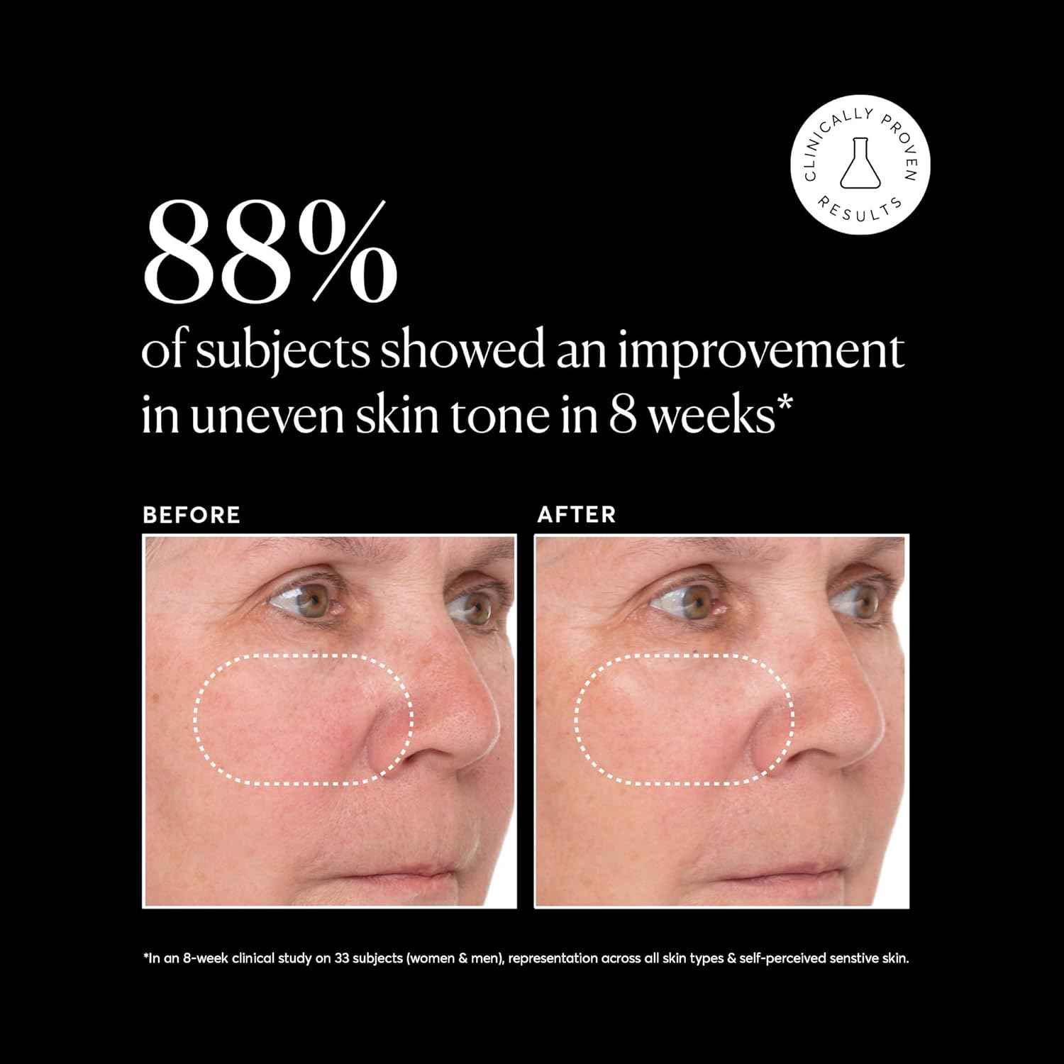 Naturium Vitamin C Super Serum Plus, Smoothing Face Care, plus Retinol, Hyaluronic Acid, Niacinamide & Salicylic Acid