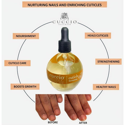 Natural_Revitalizing-_Hydrating_Oil_For_Repaired_Cuticles_Overnight_-_Remedy_For_Damaged_Skin_And_Thin_Nails_-_Paraben_/Cruelty-Free_Formula