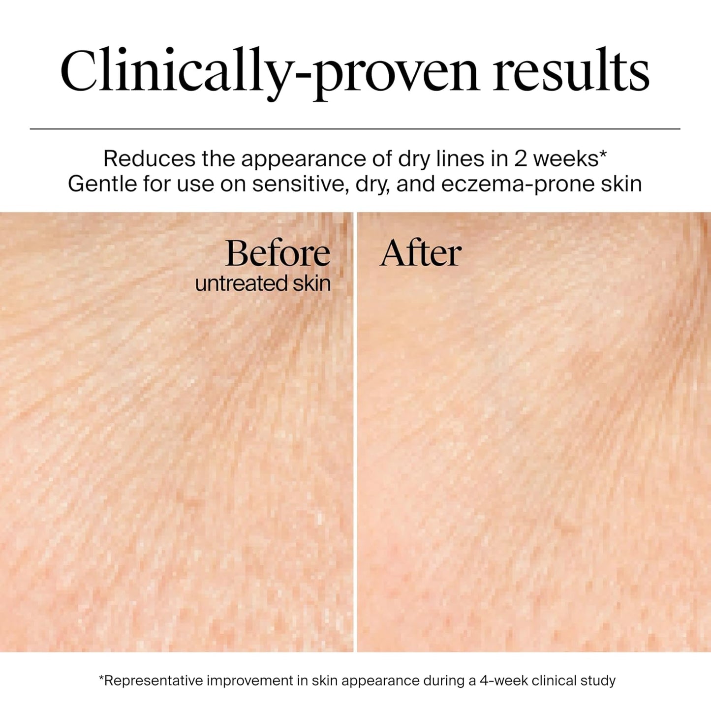 Neutrogena_Hydro_Boost_Gel_Cream,_48_Hr_Hydration_for_Normal/Dry_Skin,_Fragrance_Free,_Face_Moisturizer_with_Hyaluronic_Acid,_1.7_oz._&_Trial_Size_Hydro_Boost_Hydrating_Gel_Cleanser,_0.5_fl_oz