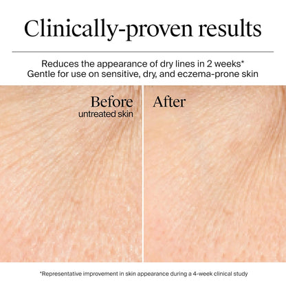 Neutrogena_Hydro_Boost_Gel_Cream,_48_Hr_Hydration_for_Normal/Dry_Skin,_Fragrance_Free,_Face_Moisturizer_with_Hyaluronic_Acid,_1.7_oz._&_Trial_Size_Hydro_Boost_Hydrating_Gel_Cleanser,_0.5_fl_oz
