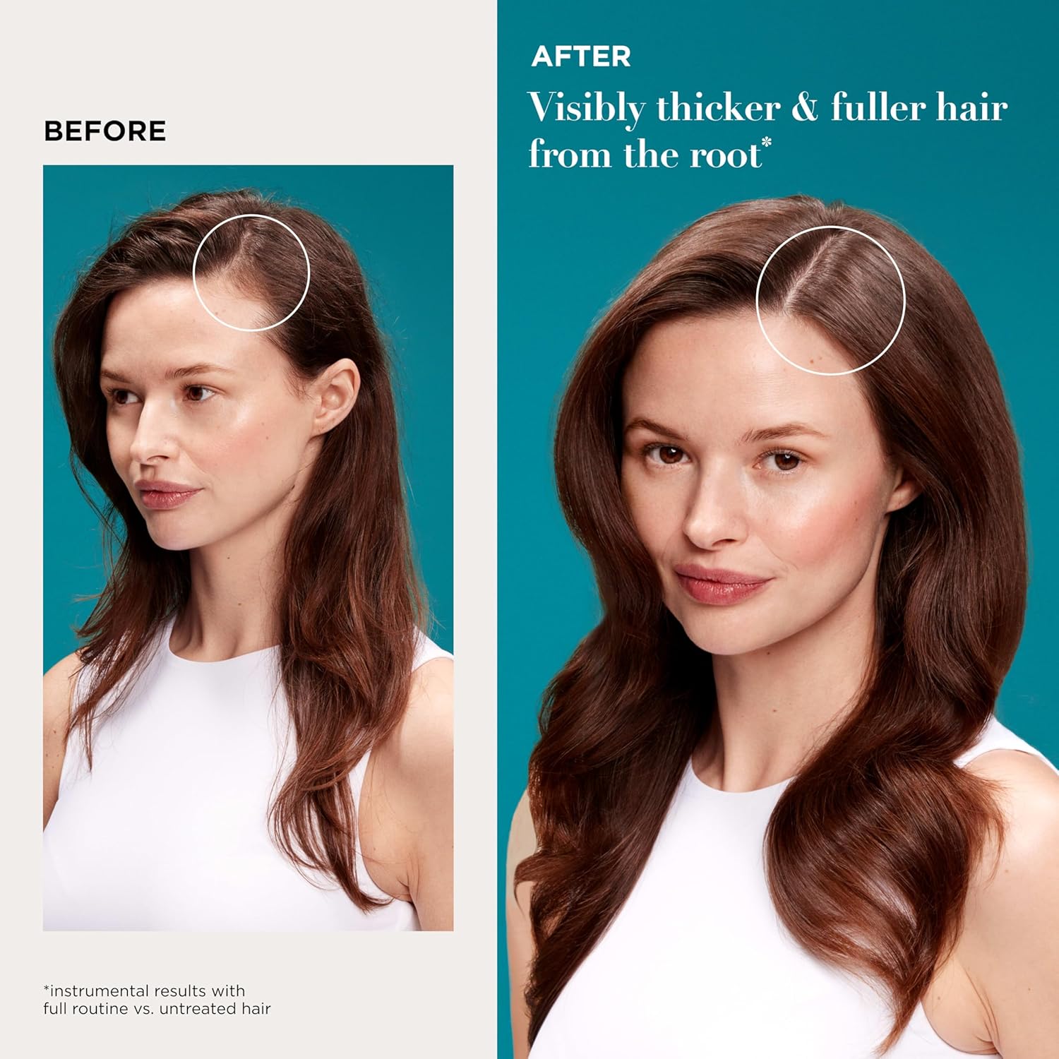 OGX_ProGrowth_+_Peptide_Scalp_Serum,_Strengthens_&_Densifies_by_Hydrating_the_Scalp_and_Reinforcing_Roots_to_Support_Natural_Hair_Growth,_0.33_fl._oz