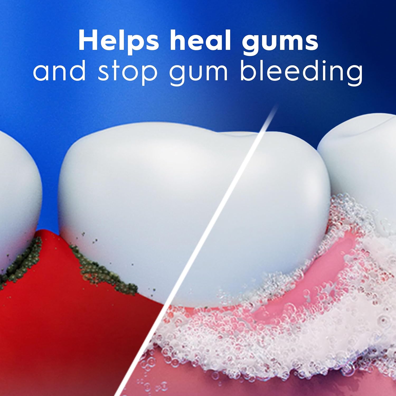 Crest_Pro-Health_Gum_Detoxify_Plus_Toothpaste_4.5_oz_Pack_of_3_-_Antibacterial_Fluoride_Toothpaste,_Sensitivity_Protection,_Whitens_Teeth,_Anticavity,_Plaque_Control