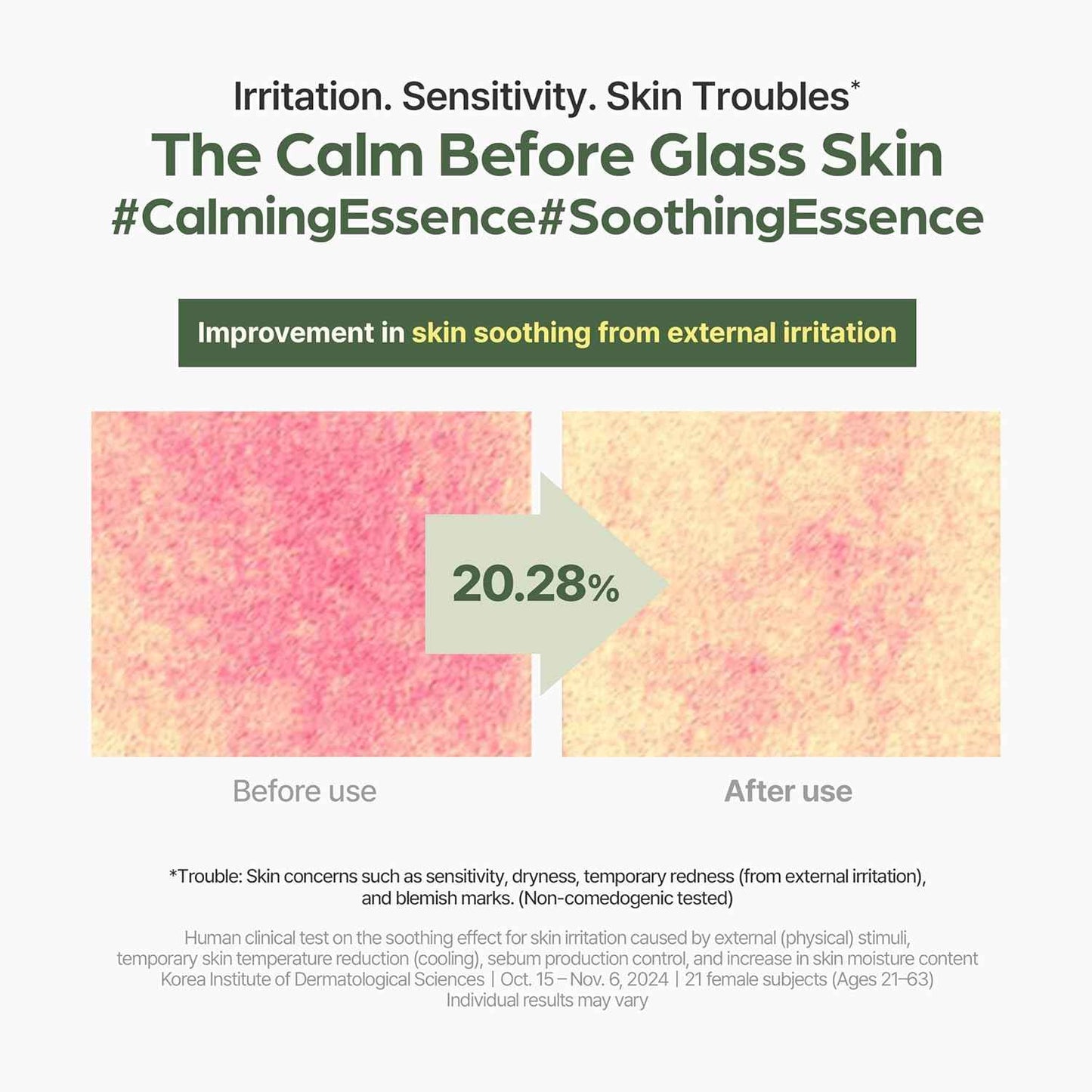 I’m From Mugwort Essence, Deep Calming Essence for Sensitive Skin, Hydrating & Skin Balancing, Vegan Korean Skin Care 5.07fl.oz