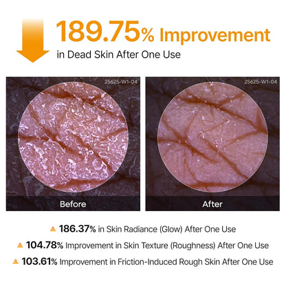 Dr.Melaxin_Body_Keratin_Care_Kojic_Acid_Turmeric_Spray_Gently_Exfoliating_Peeling_Solution_Korean_Skincare_All_Skin_Types_200ml