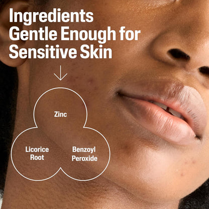 Cetaphil_Gentle_Clear_Complexion-Clearing_BPO_Acne_Cleanser_with_2.6%_Benzoyl_Peroxide,_Creamy_and_Soothing_for_Sensitive_Skin,_Suitable_for_All_Skin_Types,_4.2oz