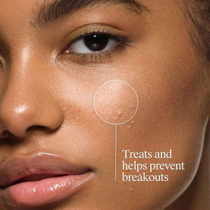 Neutrogena Oil-Free Acne Face Wash, Fragrance Free, Sensitive Skin Facial Cleanser with 2% Salicylic Acid Acne Treatment for Face, 9.1 Fl Oz