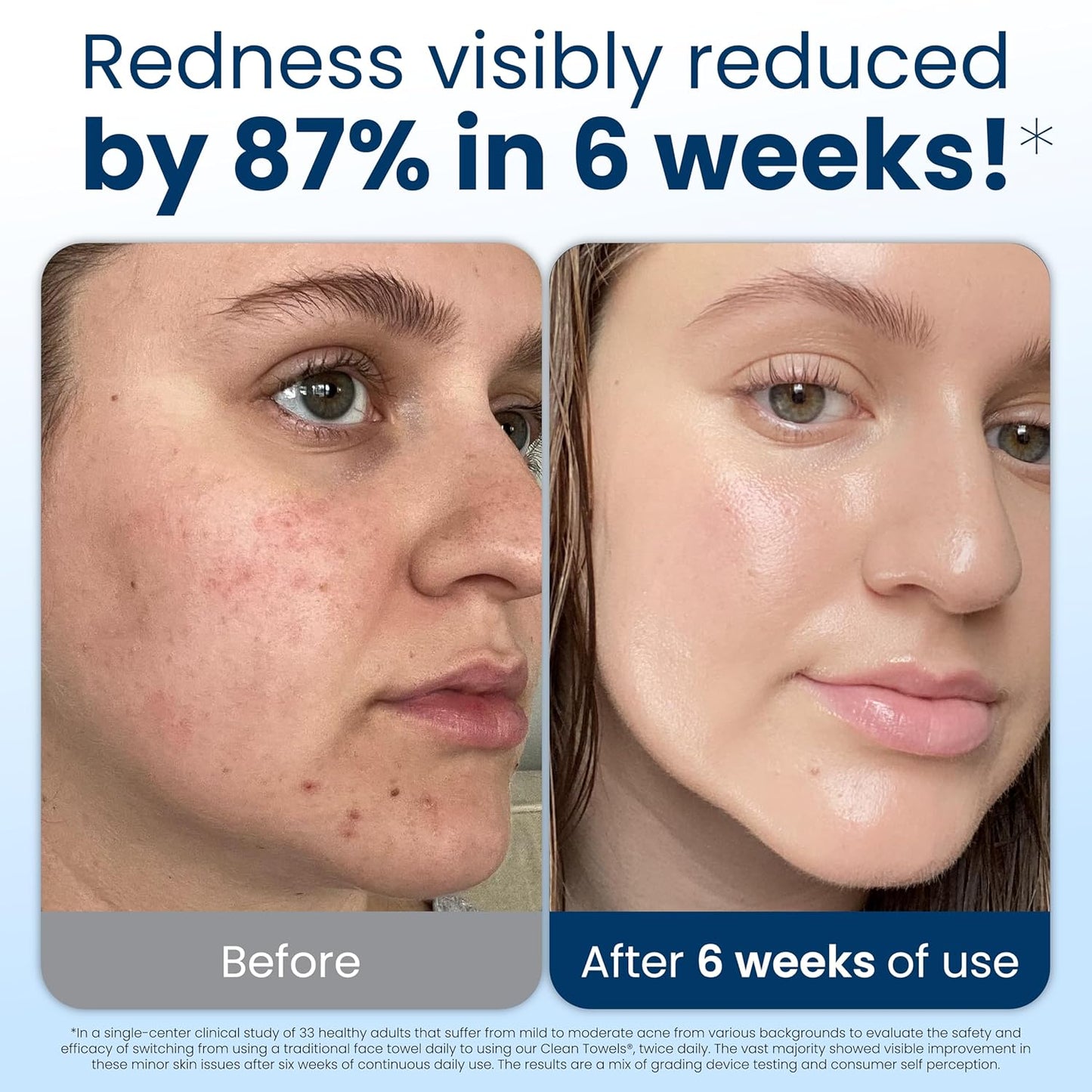 Clean_Skin_Club_Clean_Towels_XL®,_Travel_Pack_100%_USDA_Biobased_Disposable_Face_Towel,_Eczema_Association_Accepted,Dry_Wipes,_TSA-Approved_Travel_Essential,_3_Packs,_30_ct_Total