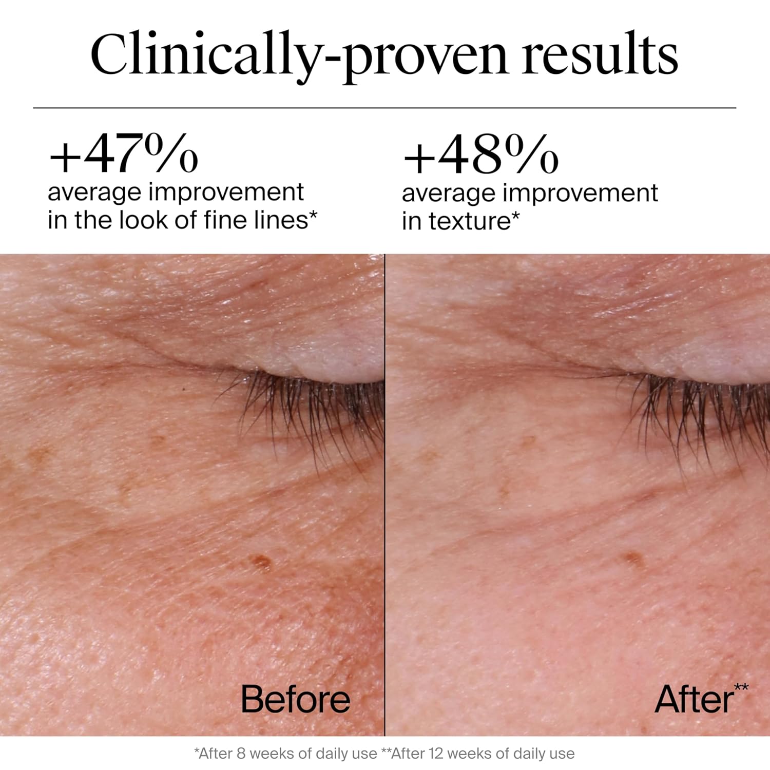 Neutrogena_Rapid_Wrinkle_Repair_Retinol_Face_Moisturizer,_Daily_Anti-Aging_Face_Cream_with_Retinol_&_Hyaluronic_Acid_to_Fight_Fine_Lines,_Wrinkles,_&_Dark_Spots,_1.7_oz