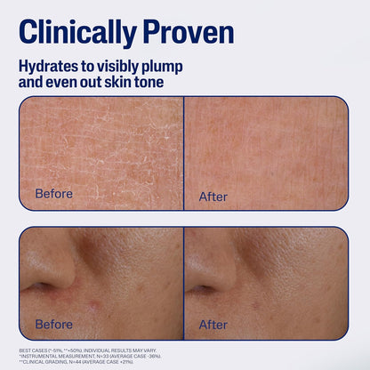 CETAPHIL_Repair_&_Renew_Night_Serum_for_Stressed_Sensitive_Skin_with_Gallic_Acid_&_Vitamin_E,_PM_Face_Serum,_Repairs_Skin_Barrier_Overnight,_Dermatologist_Recommended,_1_fl_oz_Dropper_Bottle
