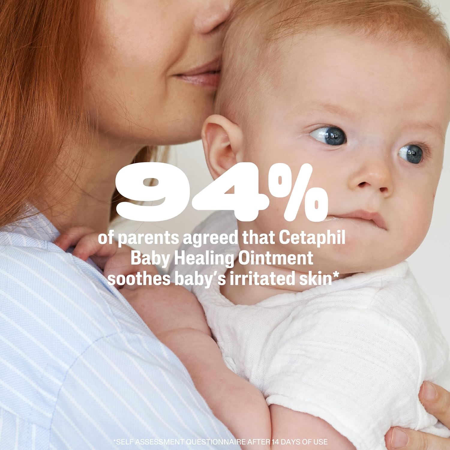 Cetaphil_Baby_Healing_Ointment,_Diaper_Rash_Ointment_Soothes_and_Protects_Baby's_Irritated_Skin,_Skin_Protectant_For_Dry_Skin,_12oz