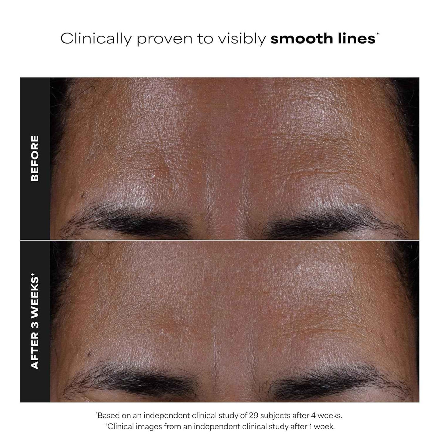 Paula's Choice SKIN PERFECTING 2% BHA Salicylic Acid Exfoliating Pads - Facial Exfoliant Pads for Blackheads, Enlarged Pores, Wrinkles & Fine Lines