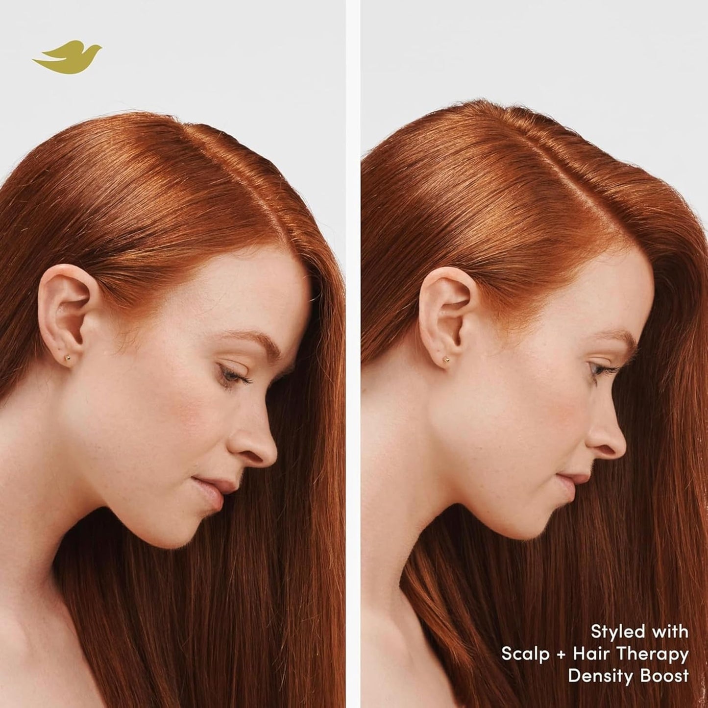 Dove_Density_Boost_Hydrating_Conditioner_Scalp_Therapy_for_Dry_Hair,_with_Vitamin_B3,_Zinc_and_0%_Sulfates,_9.25_oz