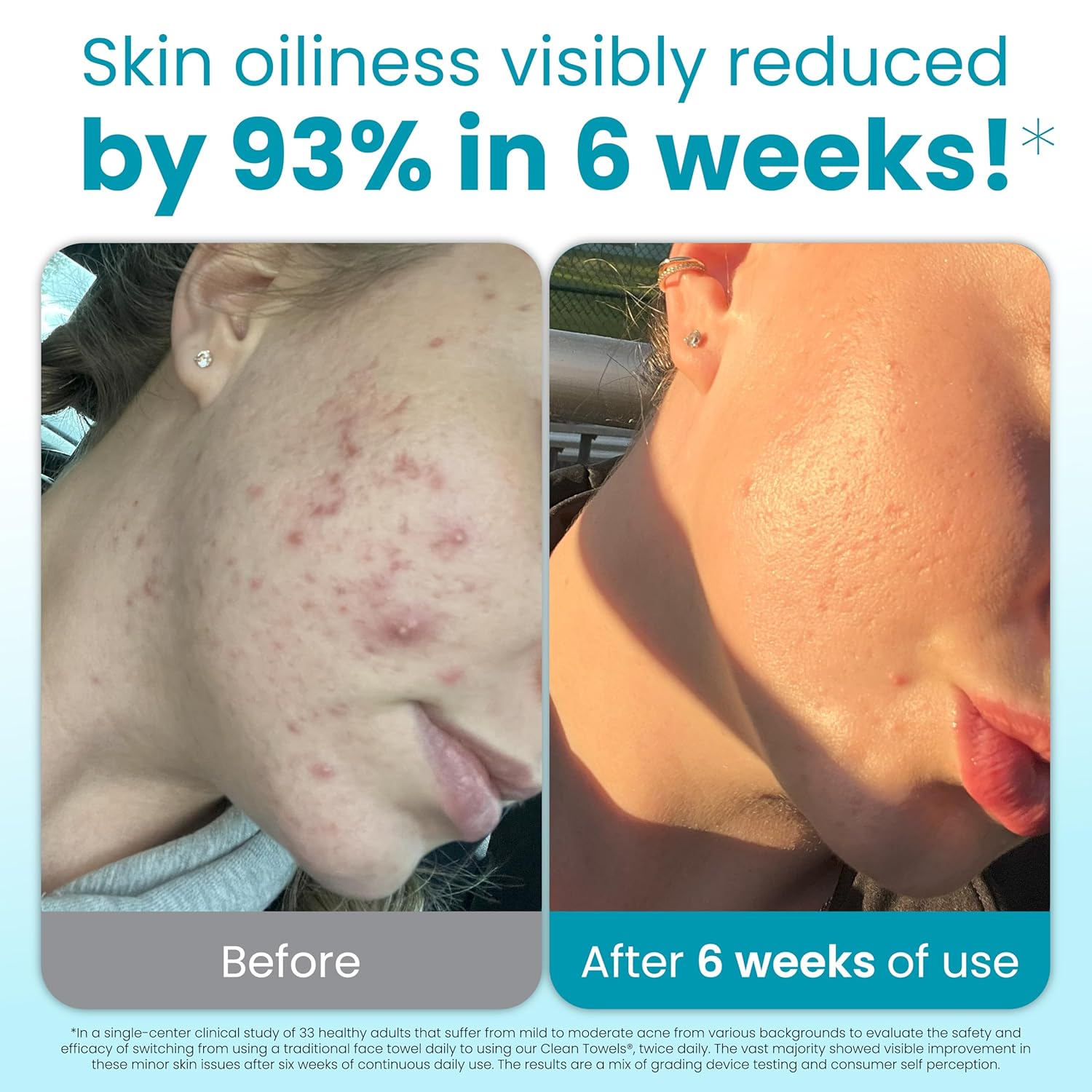 CLEAN_SKIN_CLUB_Blemish_Control_Clean_Towels®_XL,_Extra_Exfoliation_for_Oily_Skin,_Disposable,_Single-Use_Face_Towelette_Dry_Wipe_-_1_Pack_(50_Count)