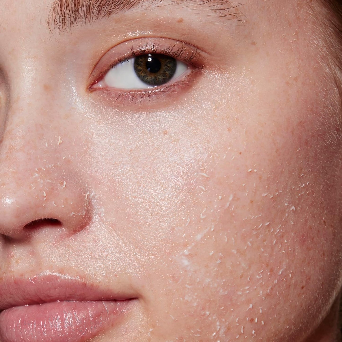 e.l.f._SKIN_Gentle_Peeling_Exfoliant,_Cleanser,_Effective,_Easy_to_Apply,_Peels_Away_Dead_Skin,_Removes_Dirt,_Ideal_for_All_Skin_Types
