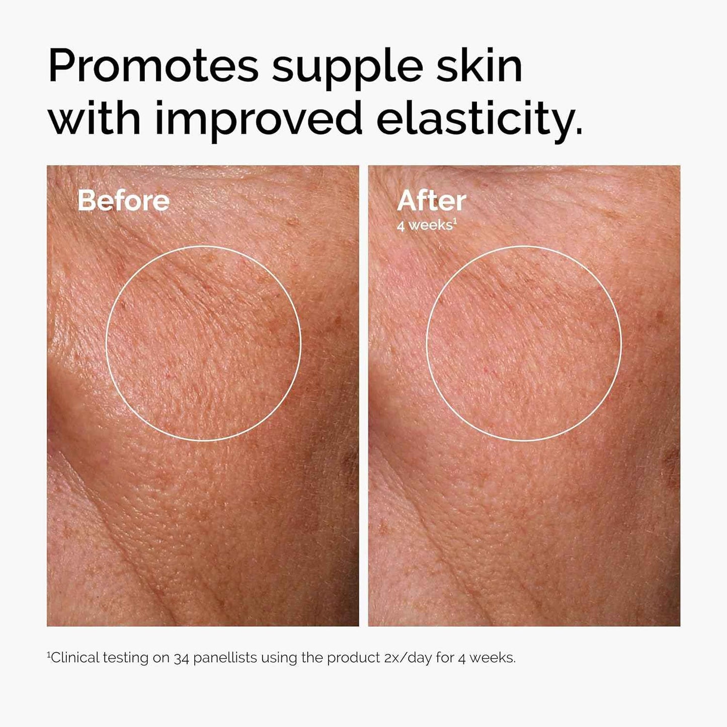 The Ordinary Serum Favorites Set – Hyaluronic Acid 2% + B5, Niacinamide 10% + Zinc 1%, Caffeine Solution 5% – Eye and Face Serums for Hydrating, Brightening & Pore-Minimizing Skin Care