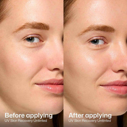 EltaMD UV Skin Recovery Face Sunscreen with Zinc Oxide, All Mineral, Safe for Sensitive Skin SPF 50